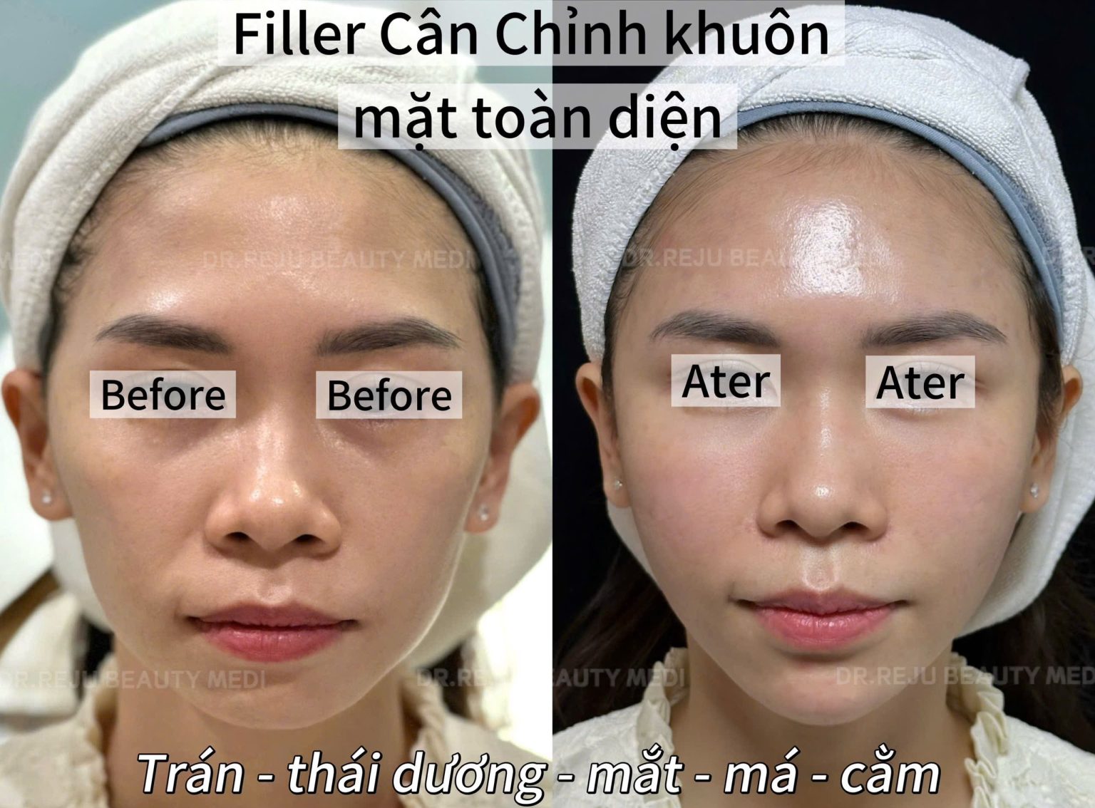 Filler Cam Lem