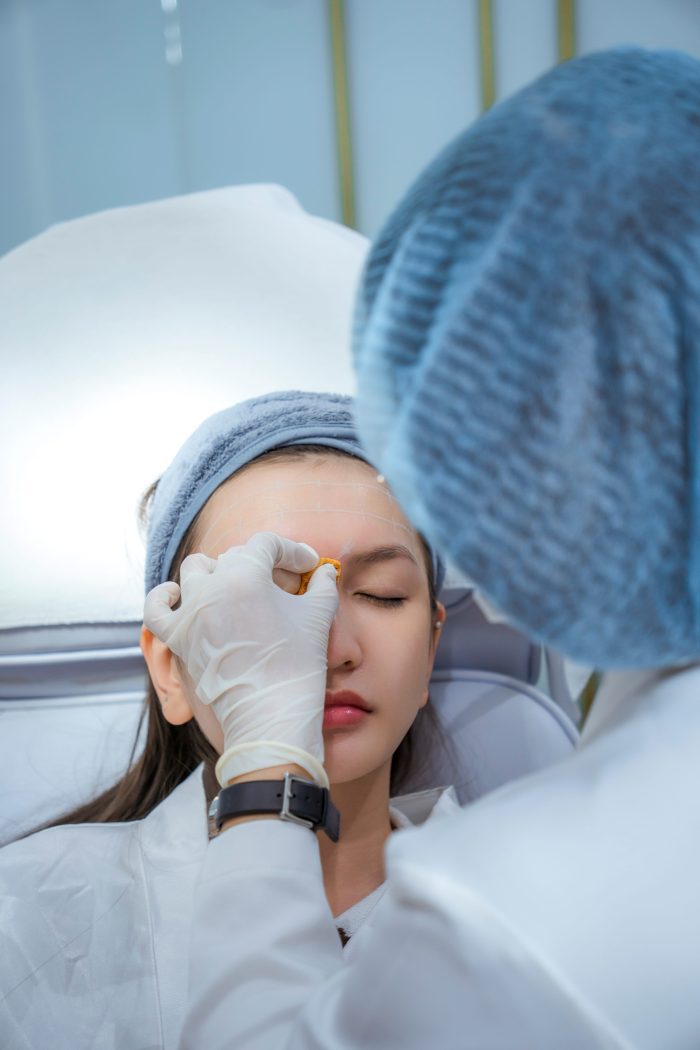 Tiêm Botox - Image 25