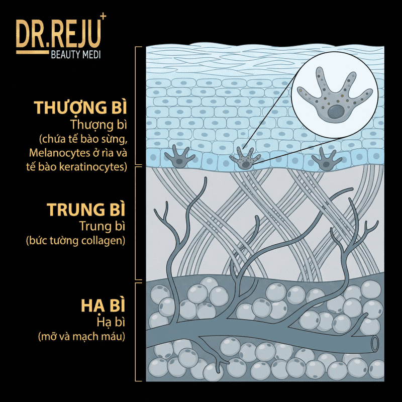 Minh họa cấu trúc da (Biểu bì vs Trung bì) và vị trí Melanocytes (1)