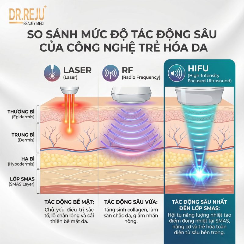 Mô phỏng cơ chế sóng siêu âm hội tụ cường độ cao Hifu tác động vào lớp SMAS giúp tan mỡ nọng cằm.