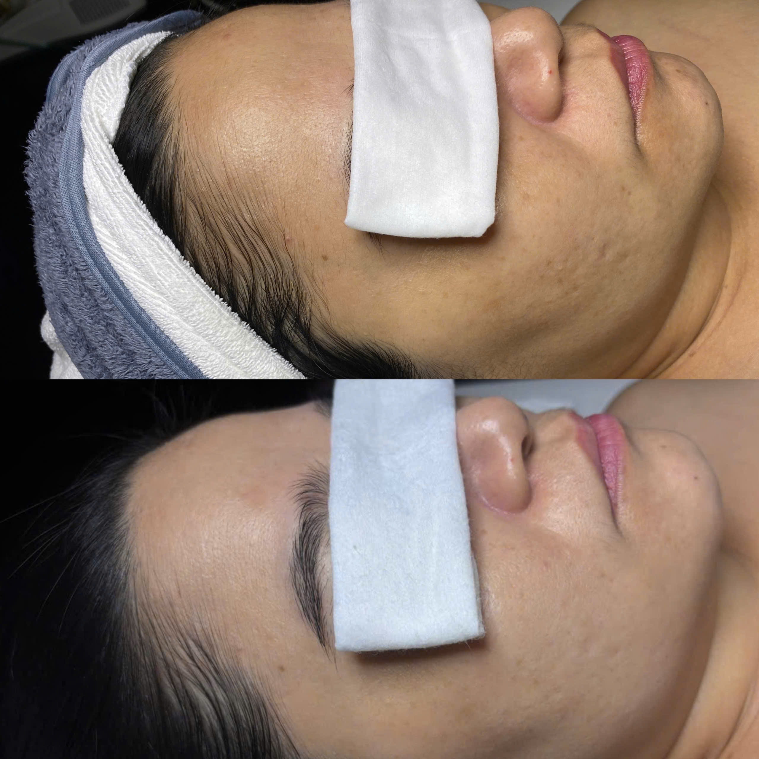 Kết quả khách hàng Dr.Reju 4
