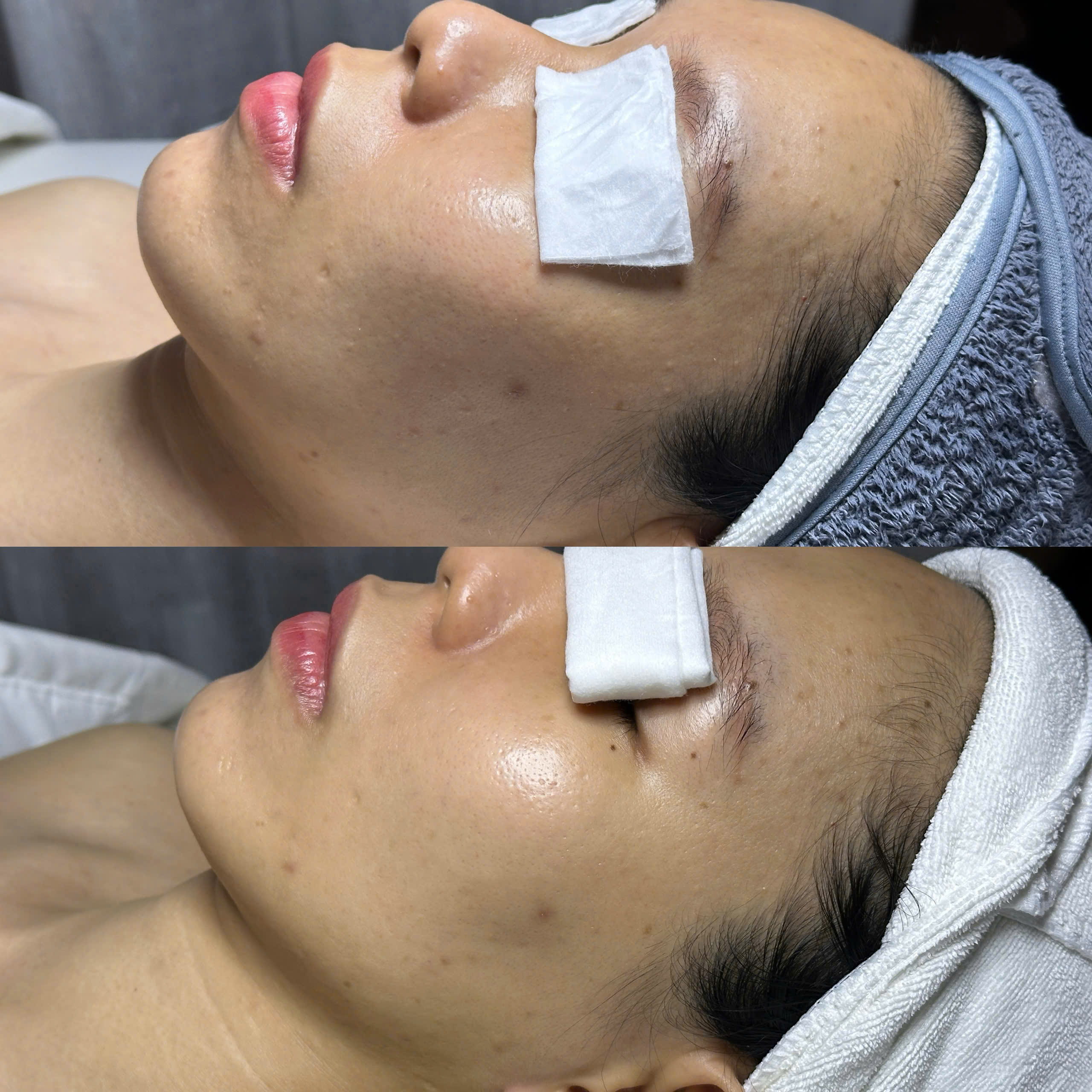 Kết quả khách hàng Dr.Reju 5