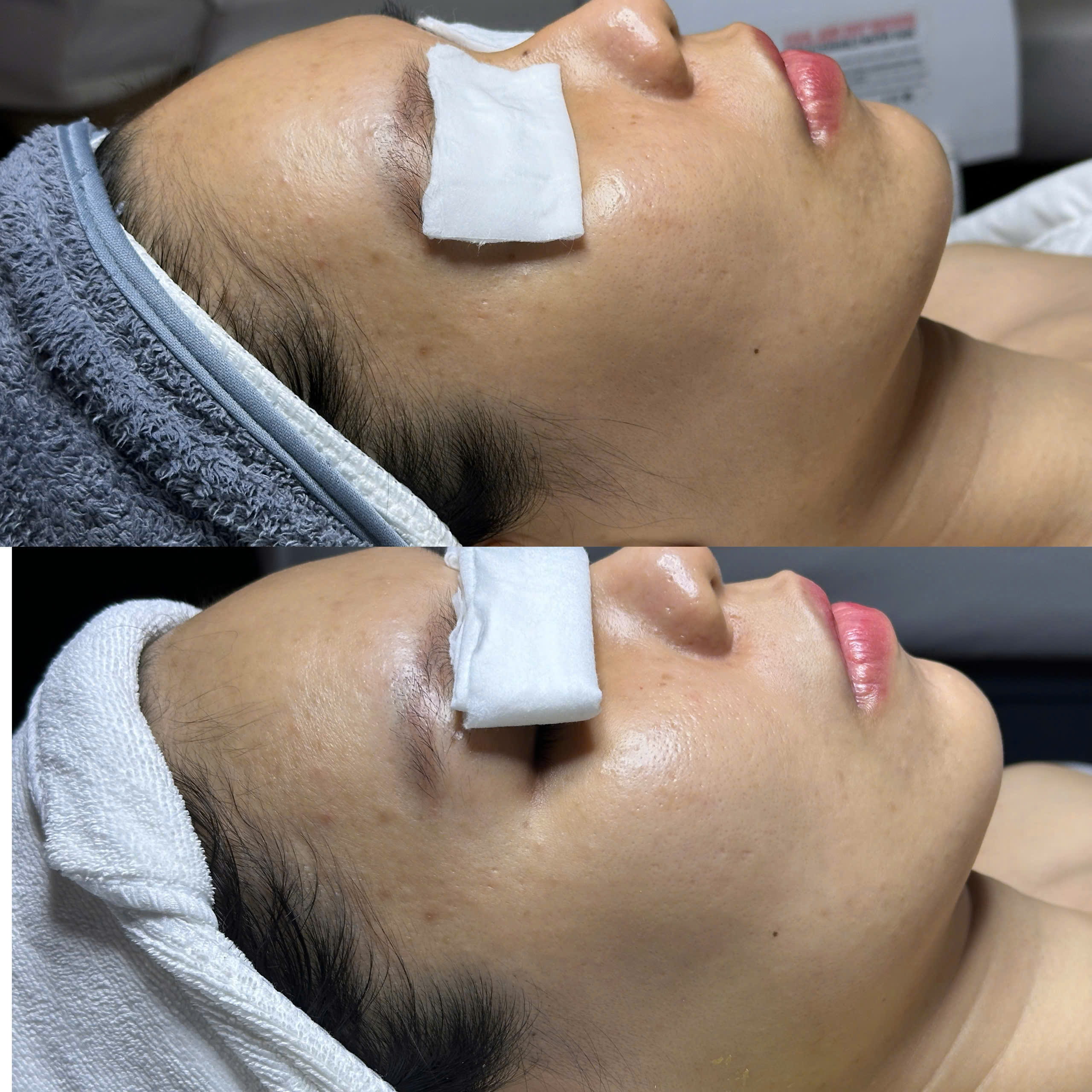 Kết quả khách hàng Dr.Reju 6