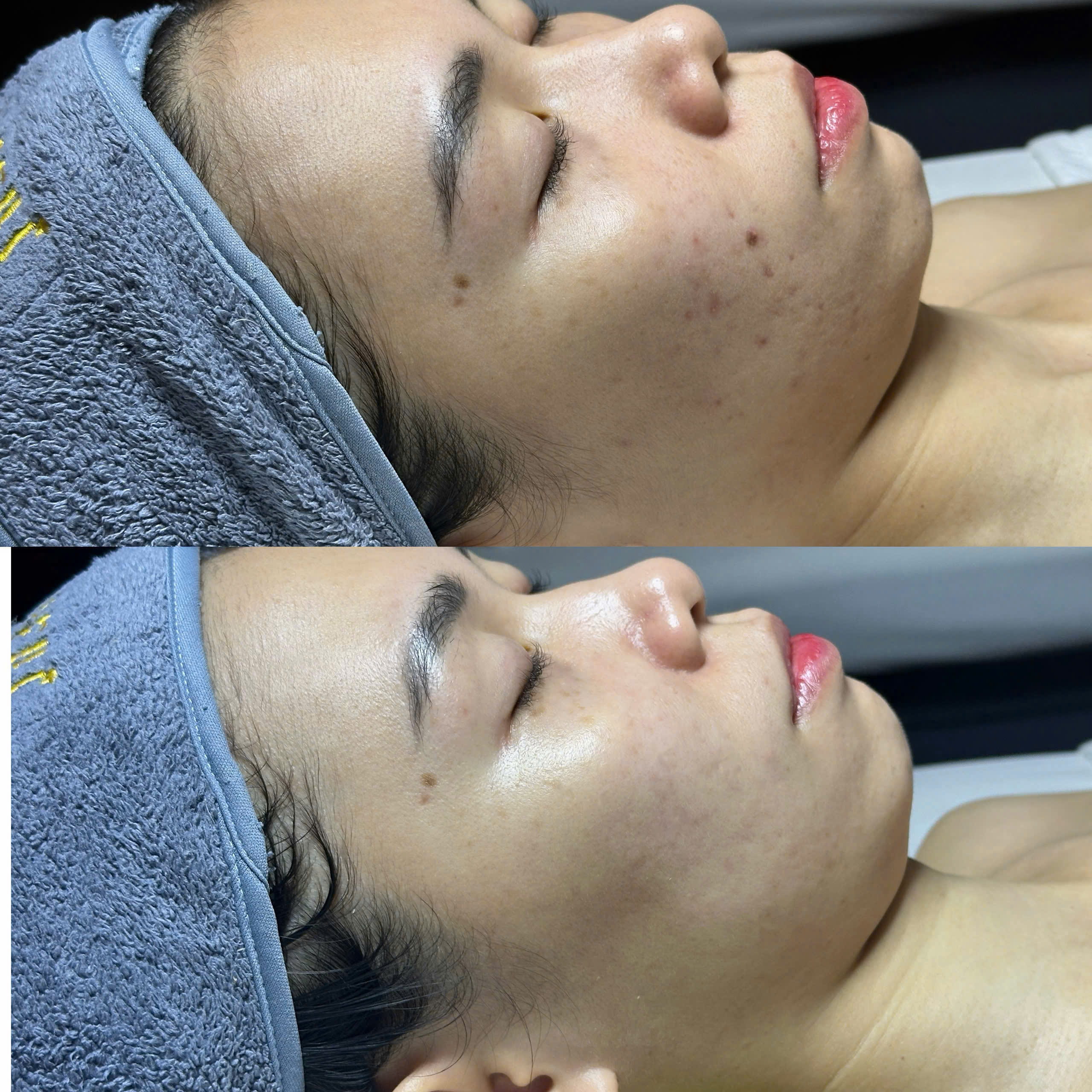 Kết quả khách hàng Dr.Reju 1