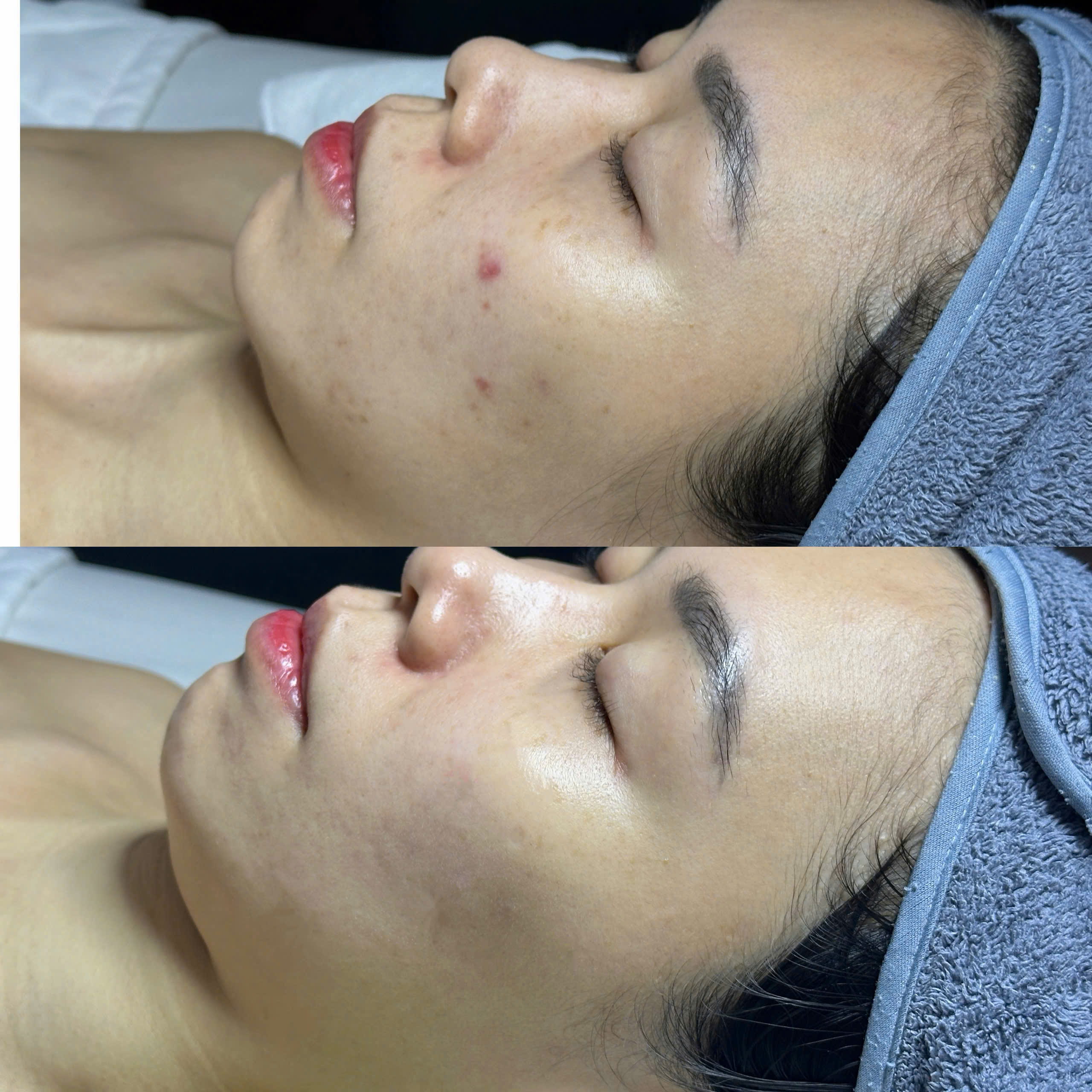 Kết quả khách hàng Dr.Reju 2