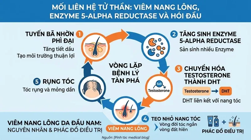 Mối liên hệ tử thần: Viêm nang lông, Enzyme 5-alpha reductase và Hói đầu