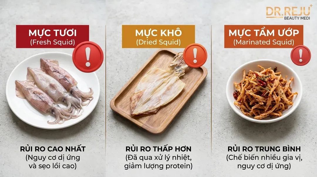 Phân biệt mức độ ảnh hưởng: Ăn mực khô có bị sẹo lồi như mực tươi?