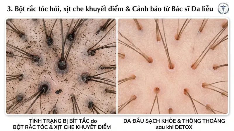 Bột rắc tóc hói, xịt che khuyết điểm & Cảnh báo từ Bác sĩ Da liễu